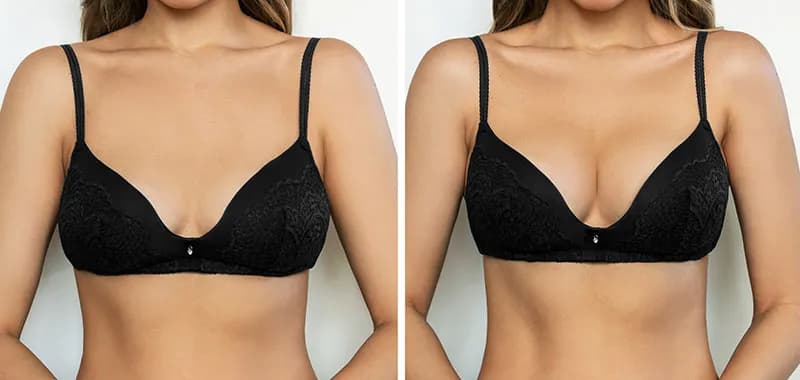 Co na powiększenie biustu forum – sprawdzone metody i opinie użytkowników