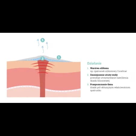 Skuteczne metody na blizny po operacji biustu, które działają